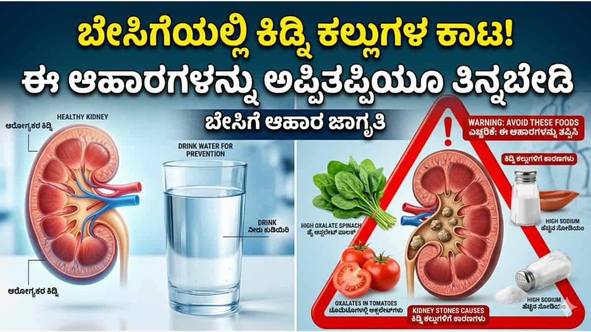 Kidney Stones: ಬೇಸಿಗೆಯಲ್ಲಿಯೇ ಯಾಕೆ ಕಿಡ್ನಿ ಸ್ಟೋನ್ ಕಾಟ ಶುರುವಾಗುತ್ತೆ? ಈ 5 ಆಹಾರಗಳನ್ನು ಅಪ್ಪಿತಪ್ಪಿಯೂ ತಿನ್ನಬೇಡಿ!